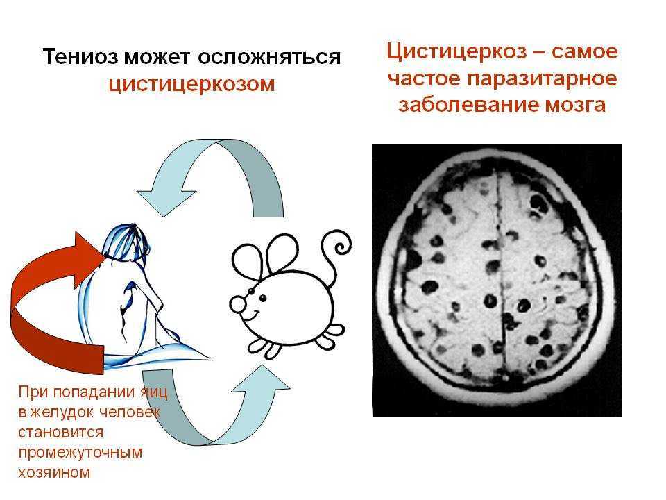 Фмц (fmc) лекарство для аквариумных рыб